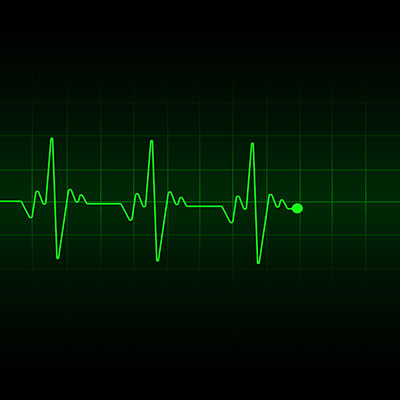 Beat frequency oscillator